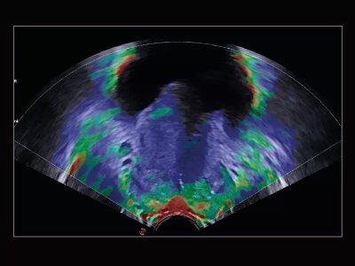 Urologija